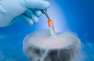 Frozen Sperm